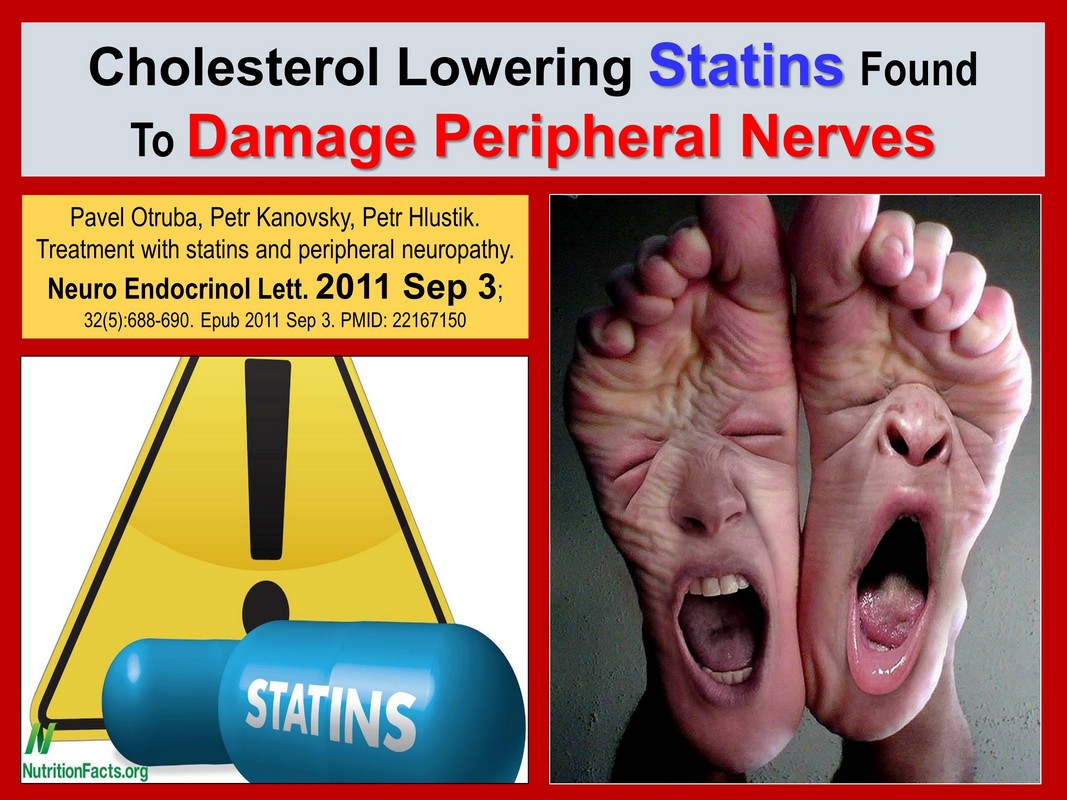 statins damage peripheral nerves (peripheral neuropathy) death by medicine