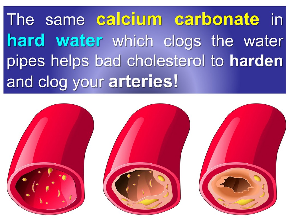 calcium carbonate in hard water cloggs arteries