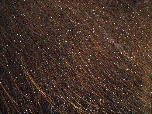 Most effective natural ways to get rid of Dandruff 